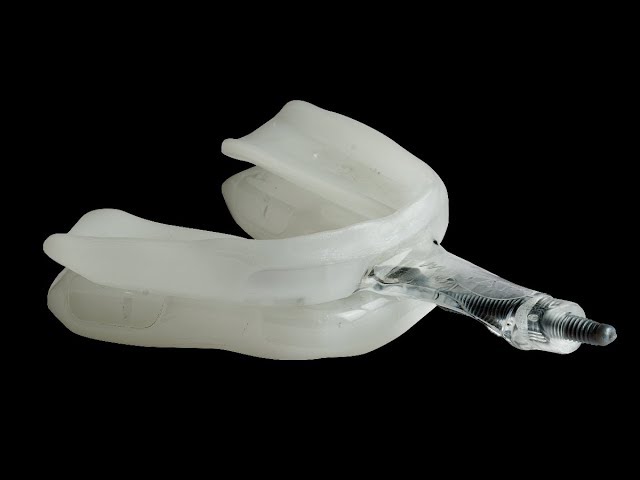 This is a photo of the myTap oral appliance. It's used to show what the device looks like, and the device is the purpose of the blog post.